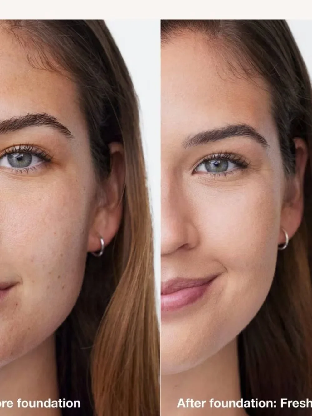 Clinique acne solutions